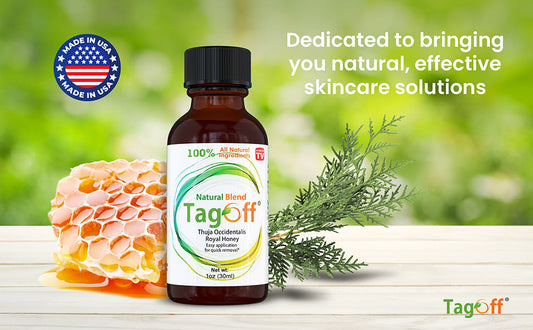 Embarrassed by Skin Tags? Why This $20 Natural Remedy is Replacing Expensive Dermatologist Visits