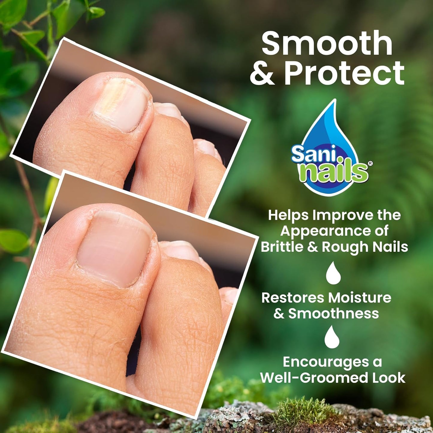SANI NAILS: Eliminate Nail Fungus Fast!