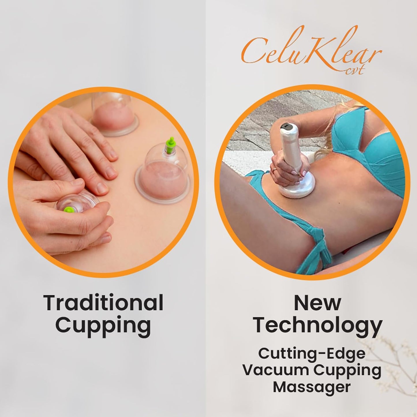 CeluKlear Electric Cupping Therapy Massager CVT 3-in-1 - Vacuum Cupping Therapy Machine for Cellulite, Deep Tissue Massage & Lymphatic Drainage – Adjustable Suction Helps Circulation & Skin