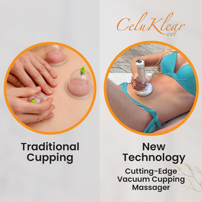 CeluKlear Electric Cupping Therapy Massager CVT 3-in-1 - Vacuum Cupping Therapy Machine for Cellulite, Deep Tissue Massage & Lymphatic Drainage – Adjustable Suction Helps Circulation & Skin